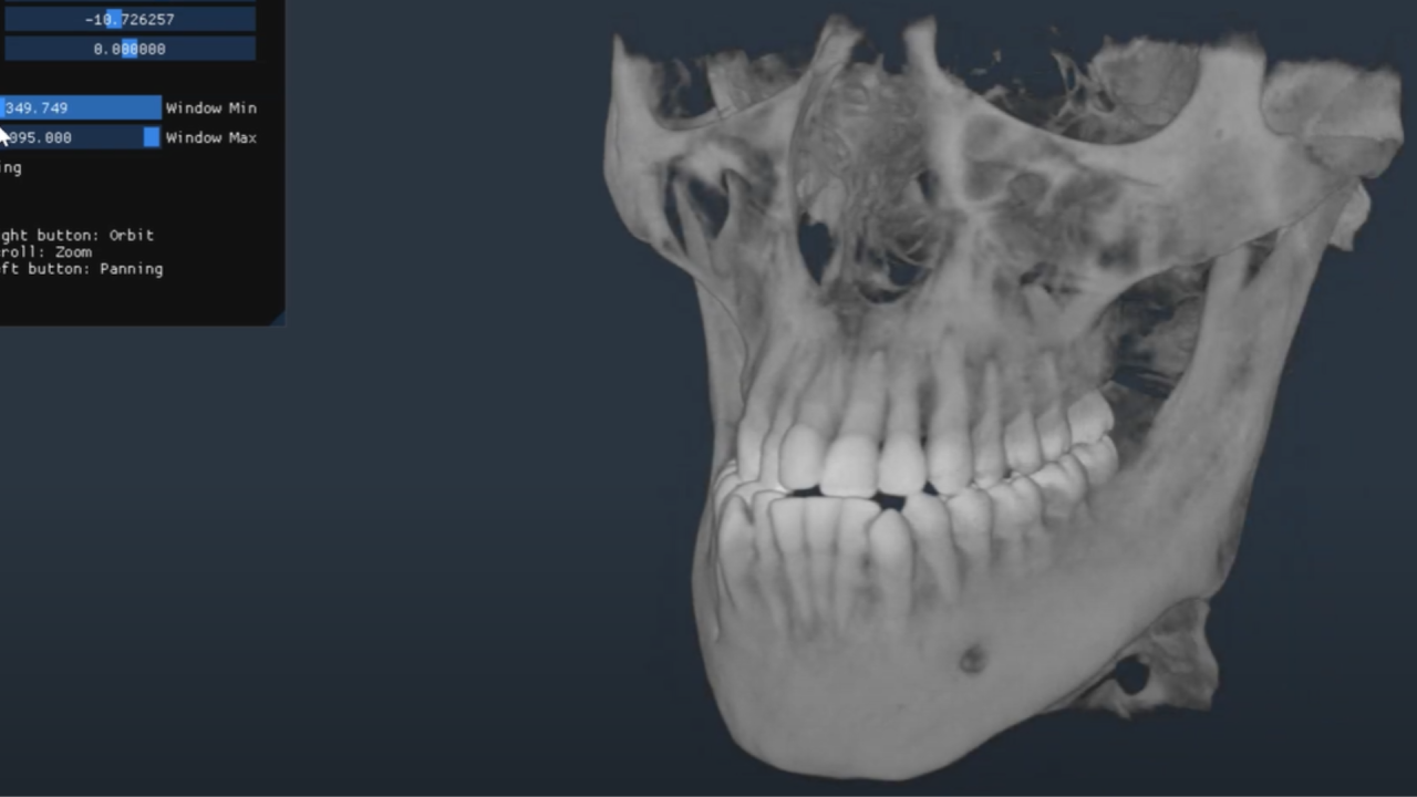 convert dicom ct mri to printable 3d stl models