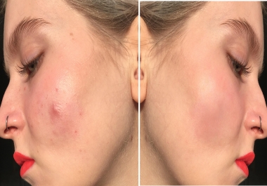 I will professionally retouch or editing any photo