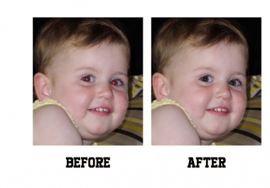 I will remove 20 red eyes from your pictures