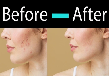 I will do dust spot pimple Dark circles Clear from images.